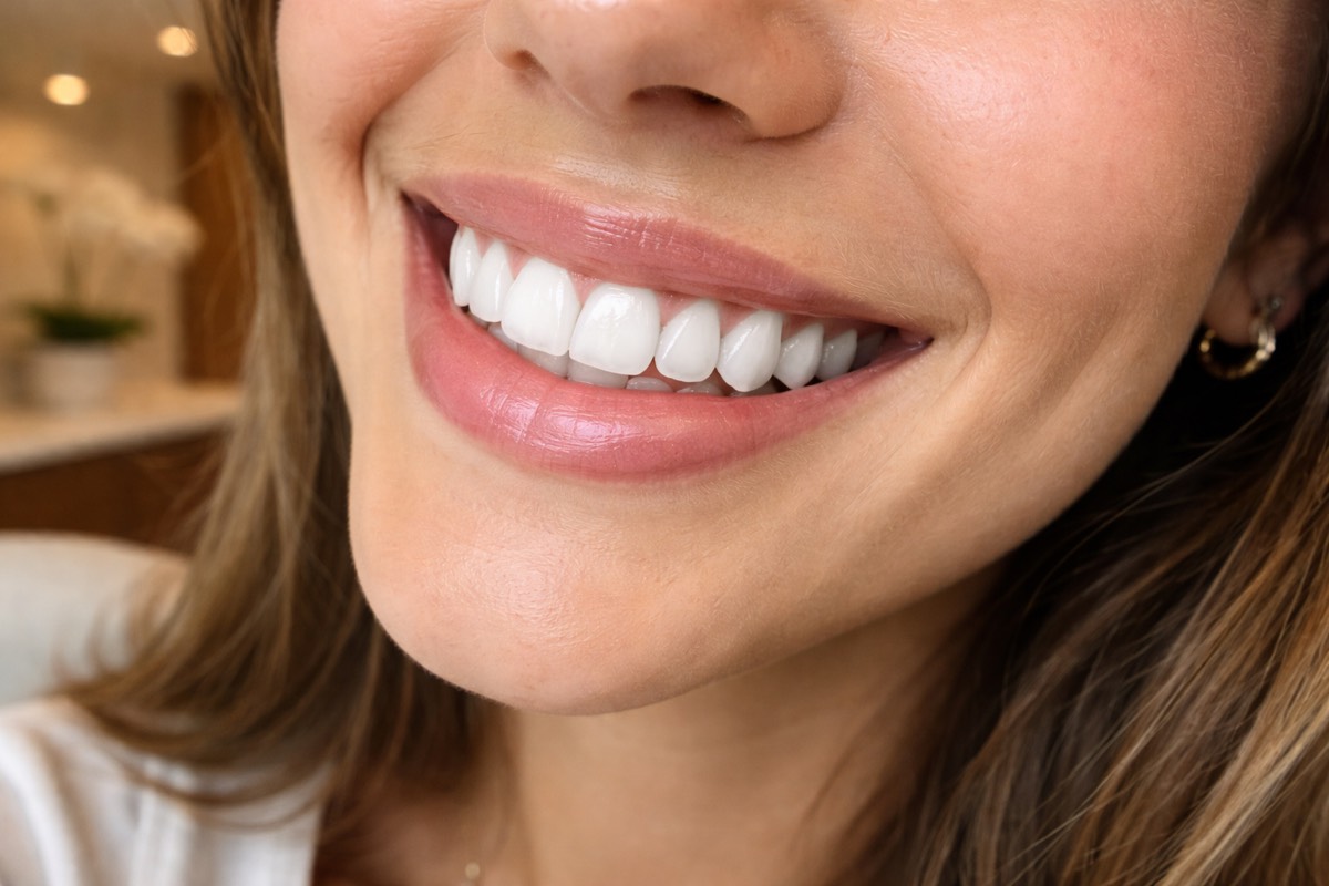 Beautiful cosmetic dentistry result